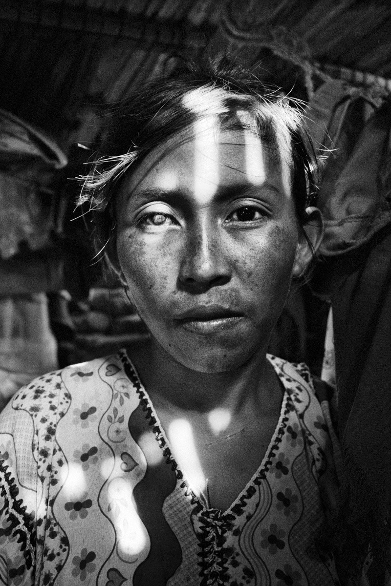 Francia Epiayu; 19; is seen during her third pregnancy. She said one of her children died from malnutrition and that she became blind during her pregnancy.
