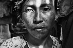 Francia Epiayu; 19; is seen during her third pregnancy. She said one of her children died from malnutrition and that she became blind during her pregnancy.