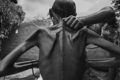 Maricela Uriana Epiayu; 22; was a mother of two children under the age of 5. Doctors said she had severe malnutrition and diabetes and had gone blind. With the help of a Bogota-based nongovernmental organization; Epiayu was taken to the hospital and received support at home with her children until her death from an infection in August 2016.